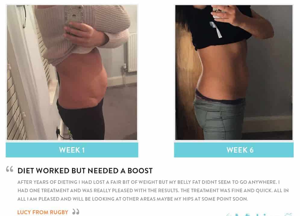 Before and After Dieting Ruislip