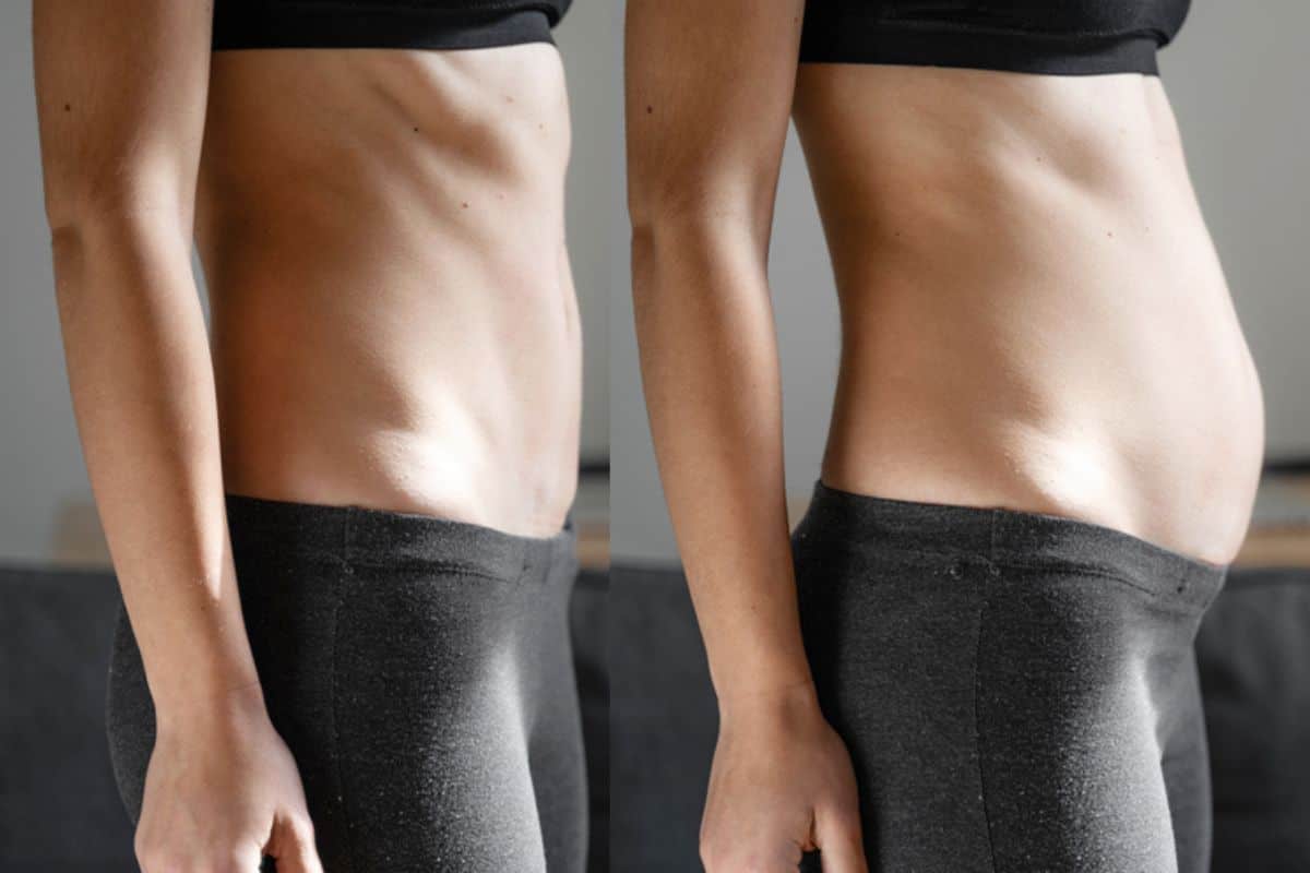 How long does diastasis recti take to improve Ruislip?