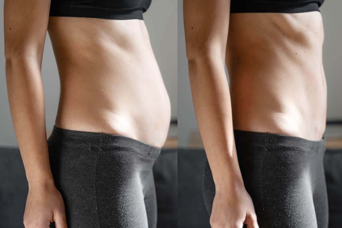 Post-Pregnancy: What Happens to Your Abdominal Muscles After Birth Ruislip