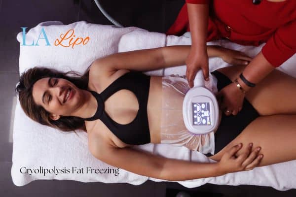 woman getting cryolipolysis Ruislip