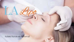 Woman receiving Actinic Keratosis Removal Treatment Ruislip