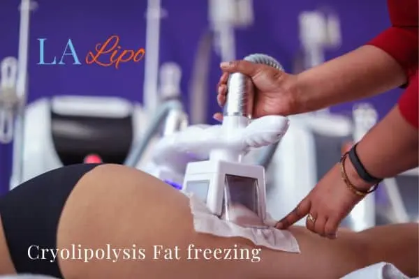 women getting fat freezing Ruislip