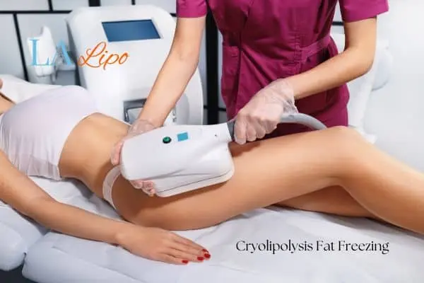 Woman receiving coolsculpting Ruislip treatment on her thighs