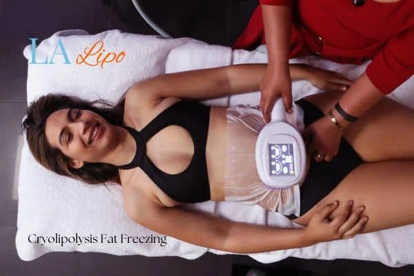 woman getting cryolipolysis Ruislip