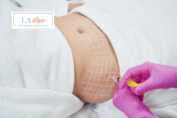 aqualyx fat dissolving injections Ruislip