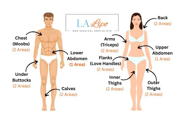 LA LIPO Cryolipolysis Areas Ruislip