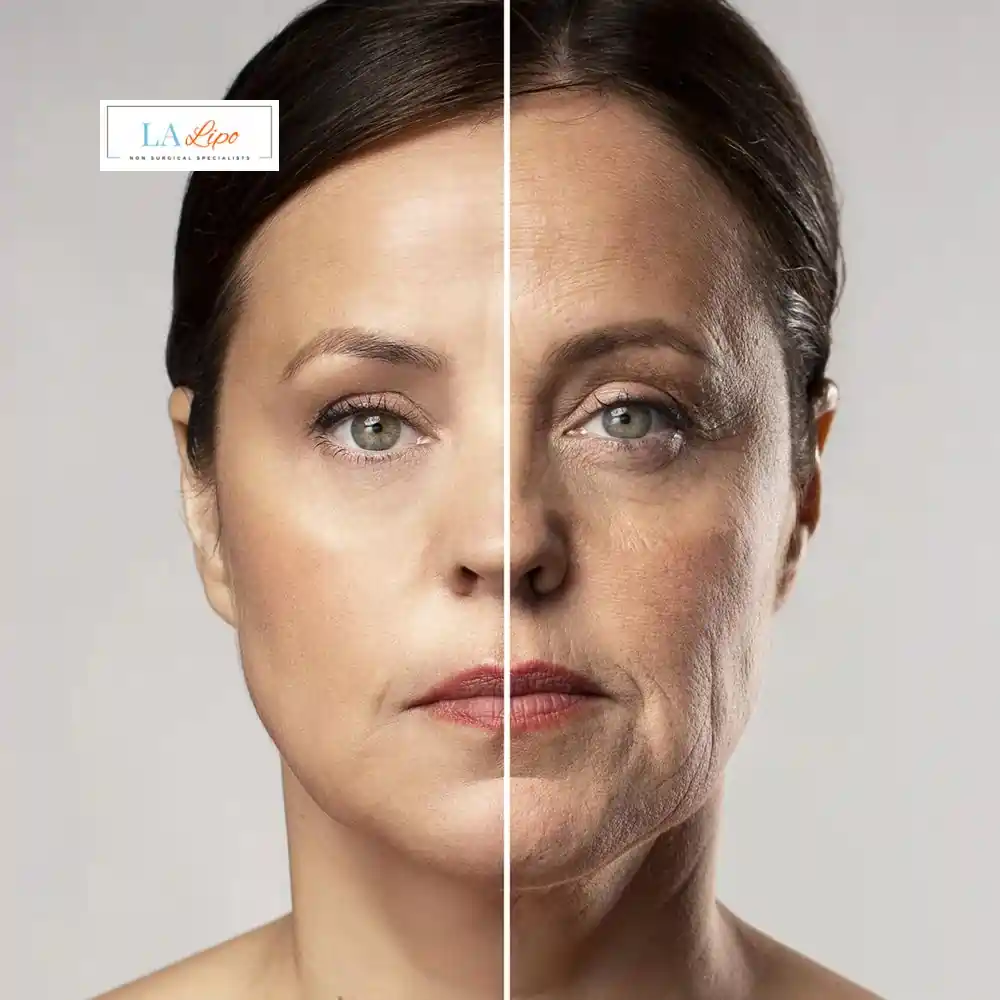 How Can You Tell If Non-Surgical Skin Tightening Is Right for You Ruislip?