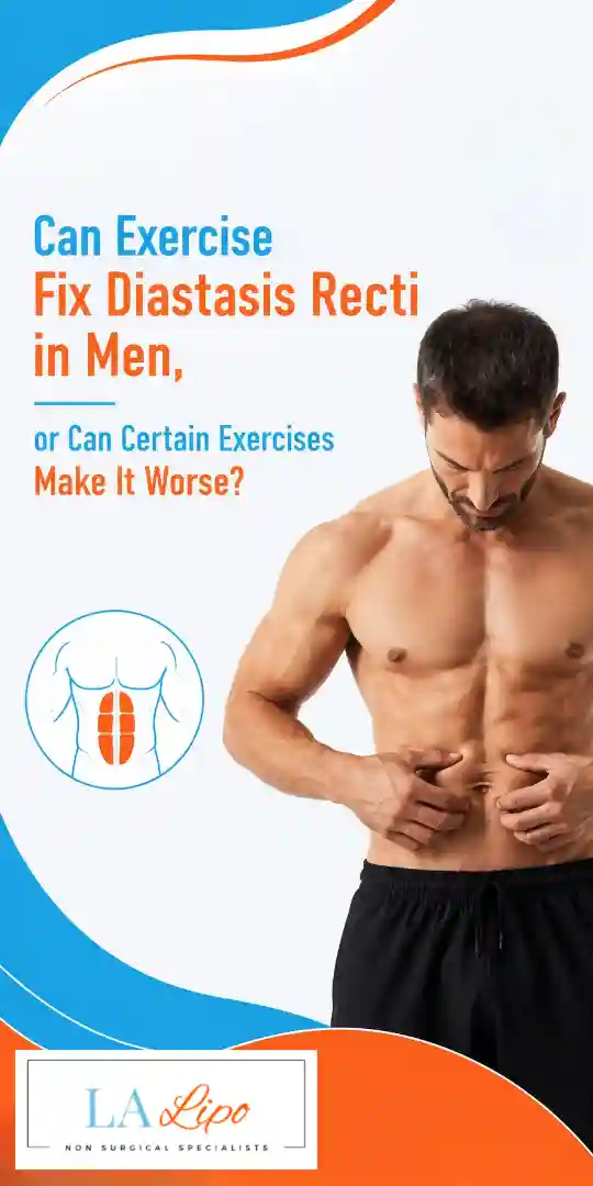 Can Exercise Fix Diastasis Recti in Men, or Can Certain Exercises Make It Worse Ruislip?