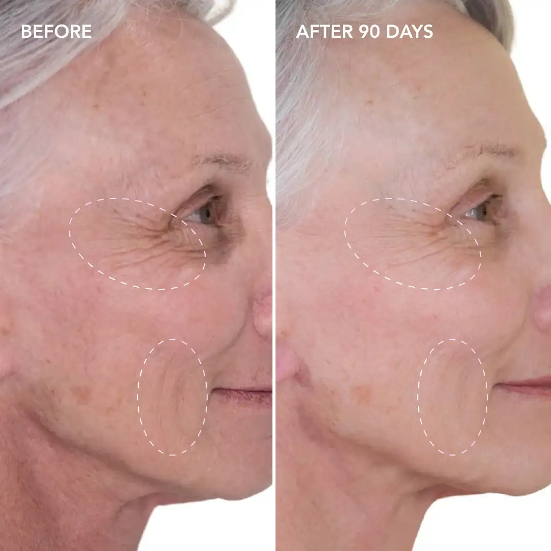 When will you see results Ruislip